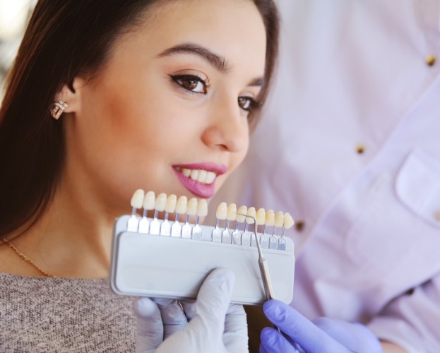 Woman's smile compared with porcelain veneers shade chart