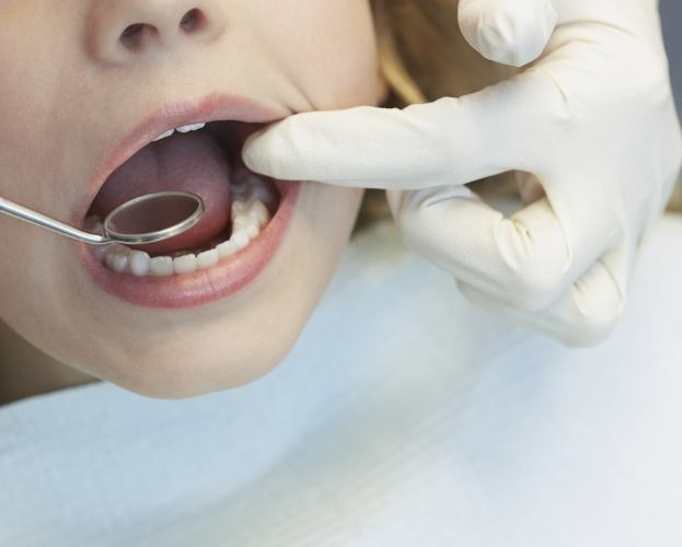 Dentist examining child's smile after tooth colored filling