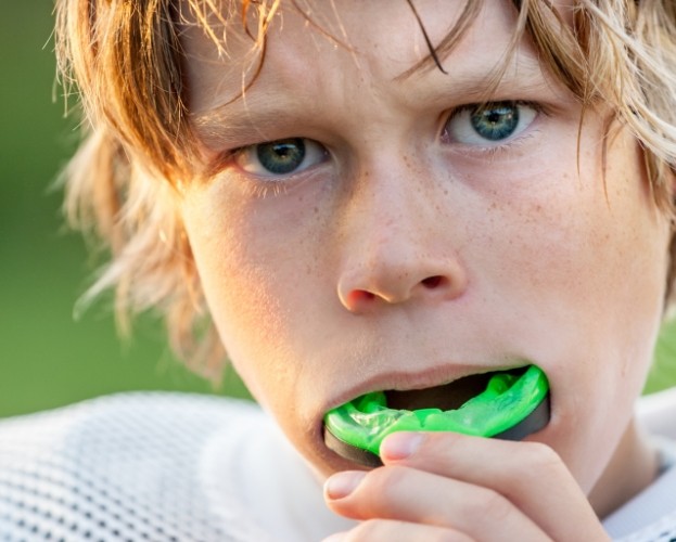 Teen placing an athletic mouthguard