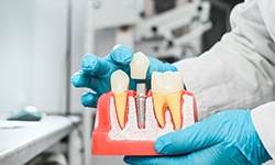 Dentist using model to talk about dental implants