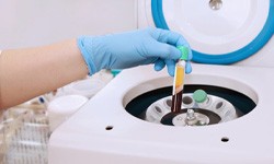 a dental technician preparing a vial of blood plasma