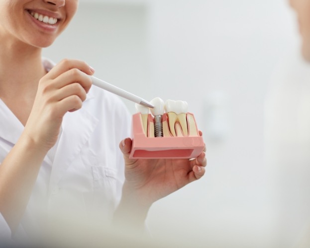 Dental team member pointing to dental implant model