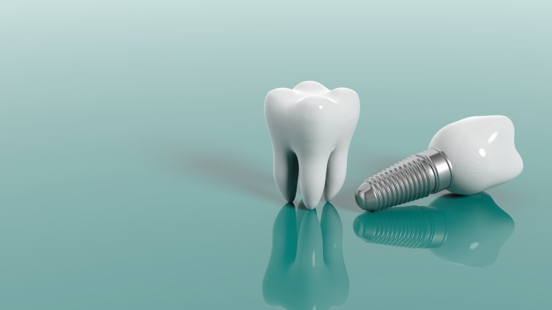 3-D Diagram of a Dental Implant